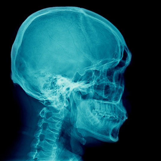 Clinical Negligence & Serious Injury